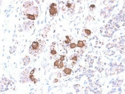 ACTH Antibody (CLIP/2040R) - Azide and BSA Free, Novus Biologicals 100